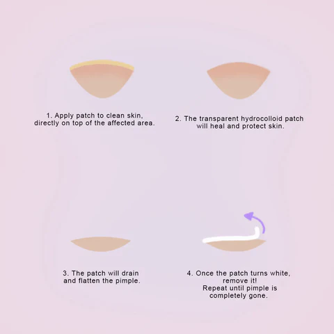 How Do Pimple Patches Work