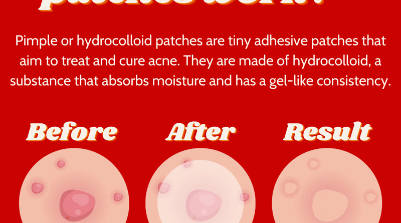 How Do Pimple Patches Work