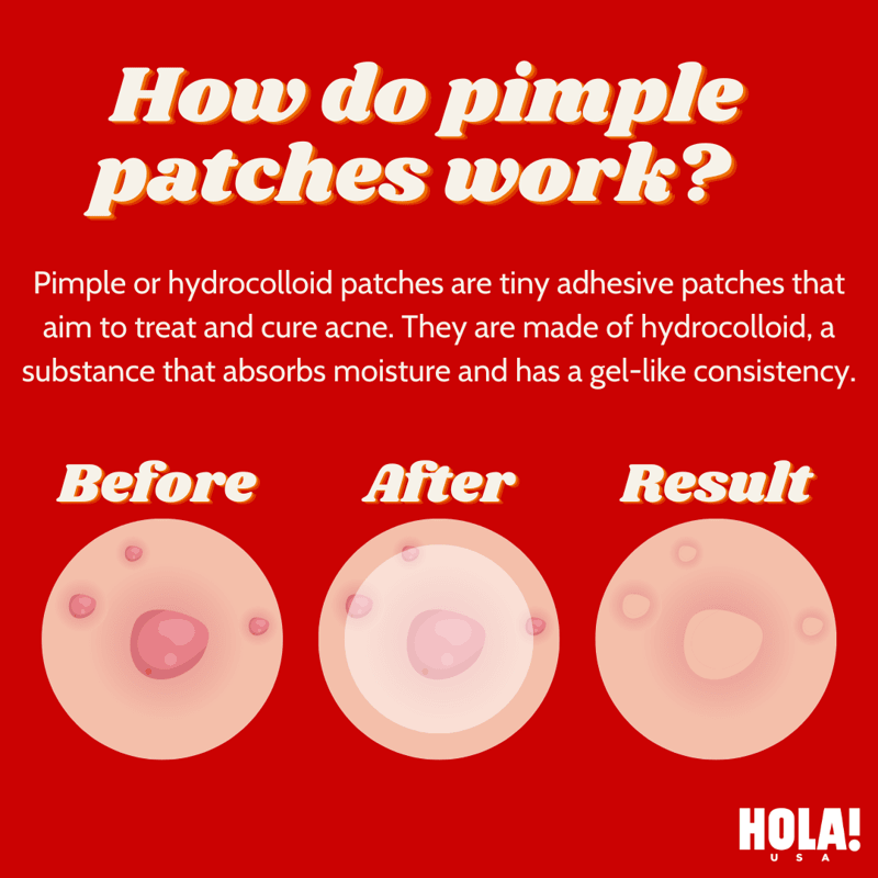 How Do Pimple Patches Work